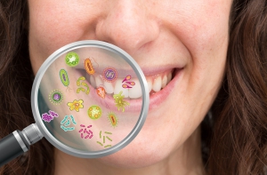 Causes and Risk Factors for Dental and Oral Health Problems