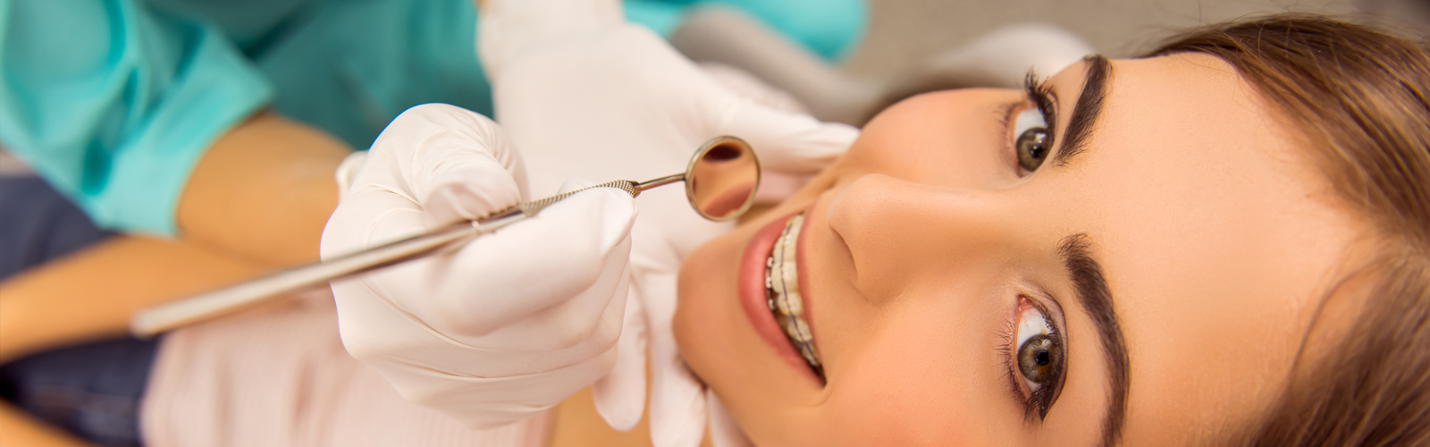 What to Know Before Getting Braces: The Complete Guide