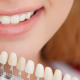 What Are Dental Veneers? Cost, Procedure & Advantages