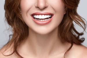 What is Teeth Whitening
